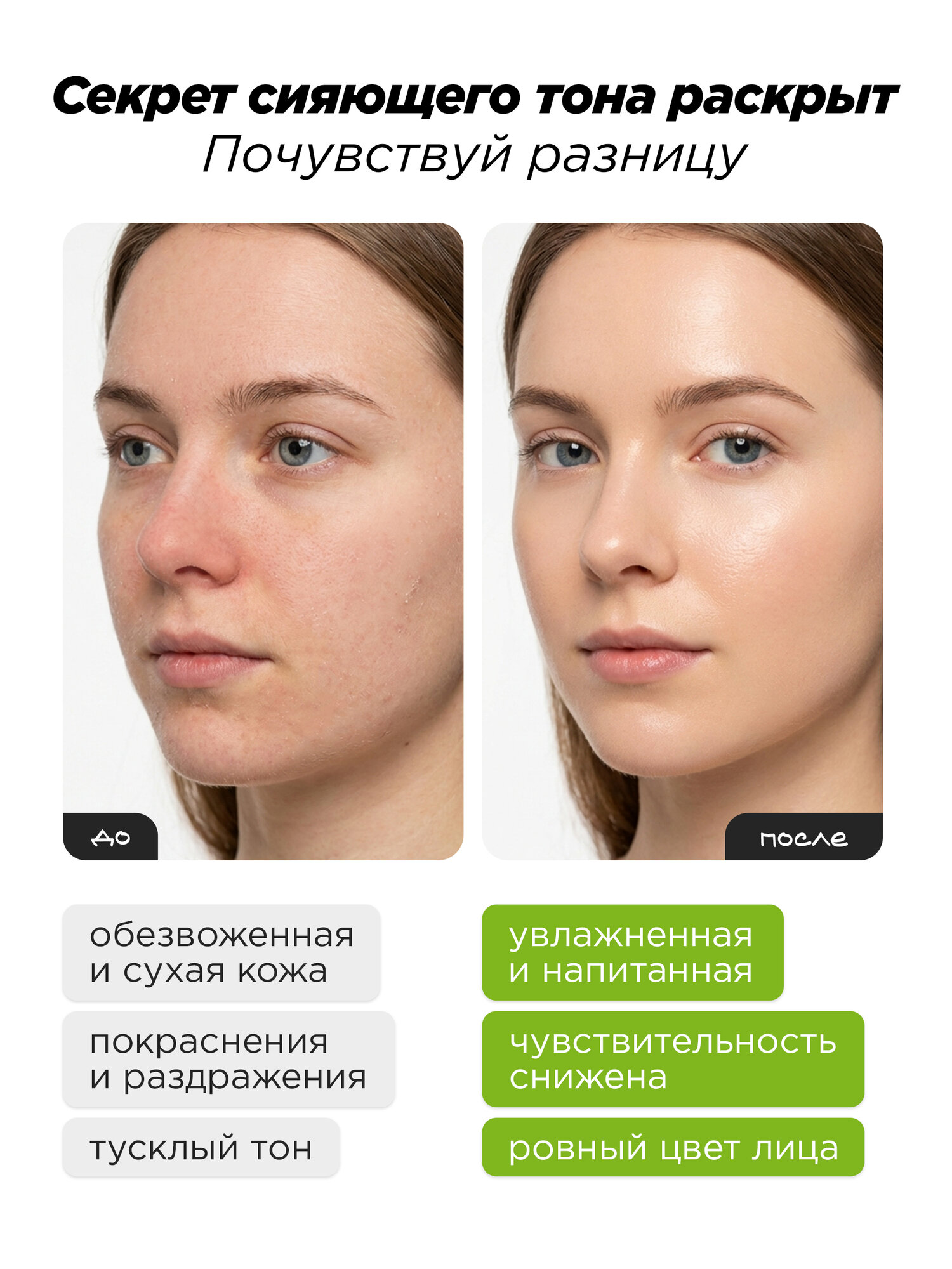 MIXIT тоник для лица универсальный с кокосовой водой для нормальной кожи — фото 1