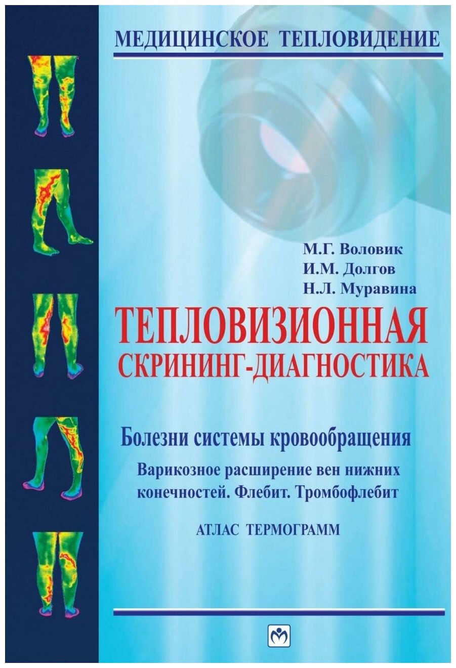 Тепловизионная скрининг-диагностика. Болезни системы кровообращения. Варикозное расширение вен - фото №1