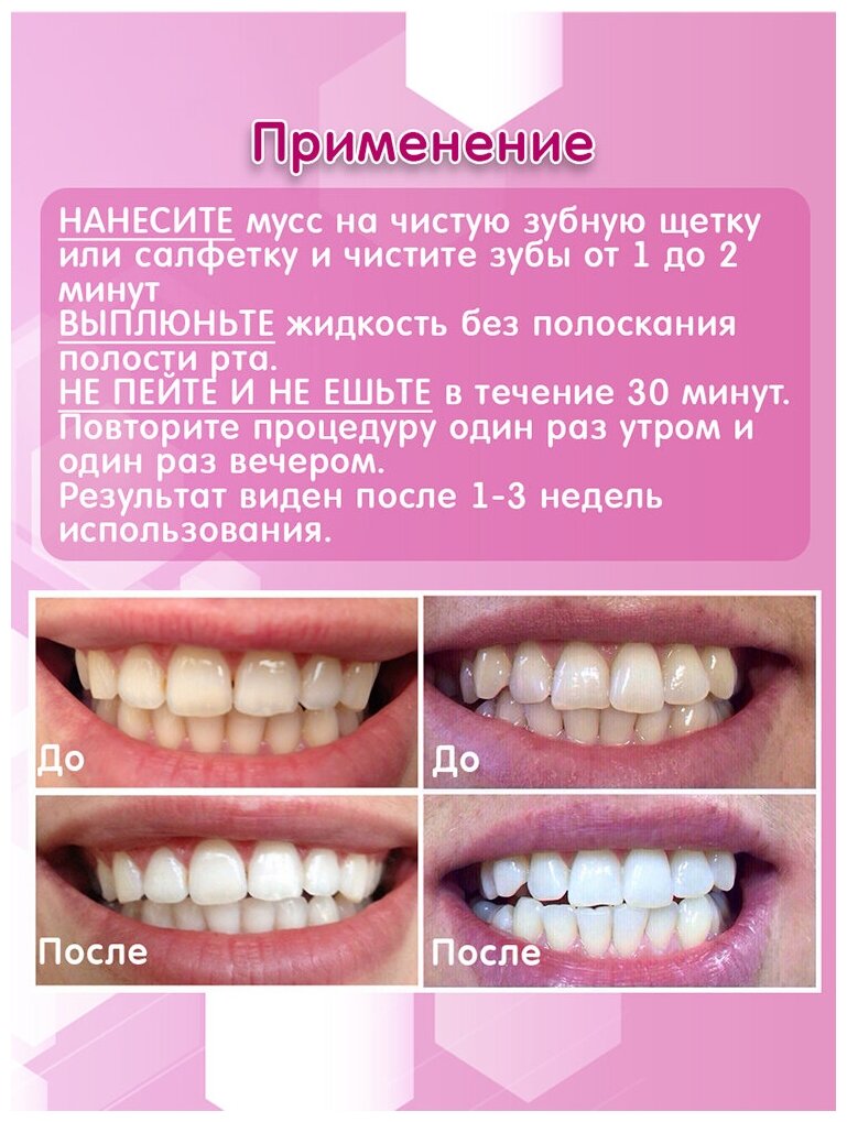 отбеливание зубов сколько стоит в иркутске