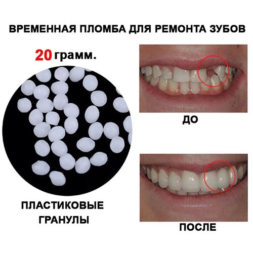 Временная пломба для ремонта зубов , пластик для самостоятельного изготовления накладных и вставных зубов и виниров / Временные зубы. 20 гр