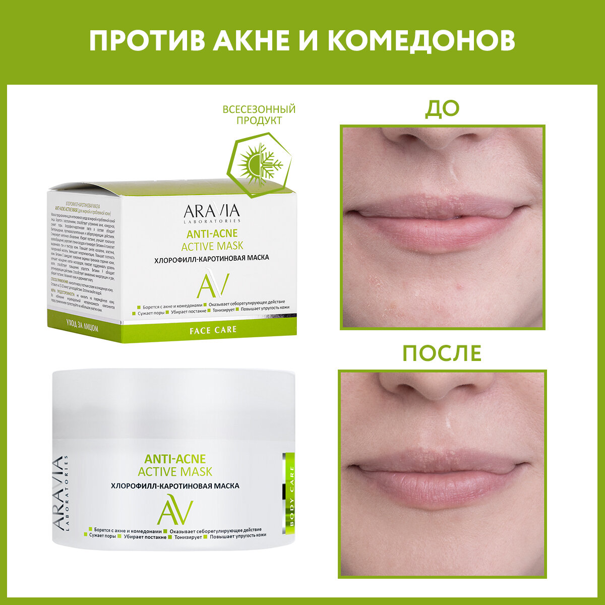 ARAVIA Маска для лица хлорофилл-каротиновая ANTI-ACNE ACTIVE MASK, 150 мл