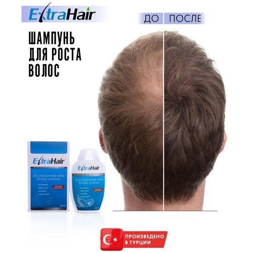 Купить Шампунь кератиновый усиленный для роста и против выпадения волос без SLS 300 мл., ExtraHair