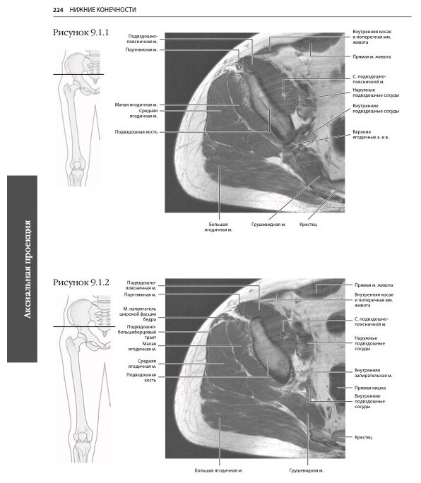 МРТ и КТ. Секционная анатомия (Марк В. Андерсон, Майкл Дж. Фокс) - фото №5