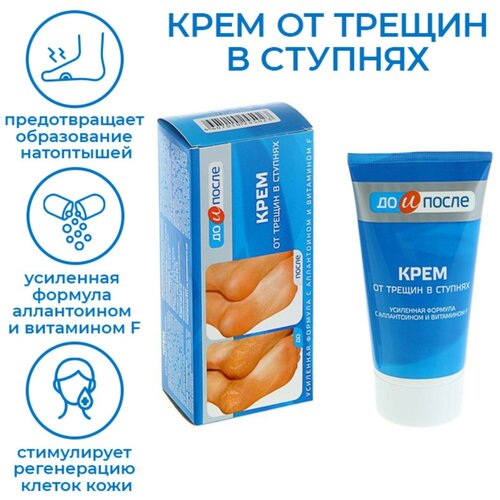 Крем для ног 