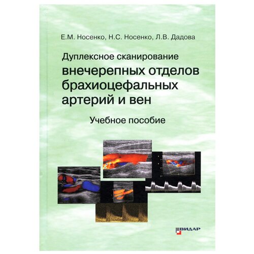 Носенко Е.М., Носенко Н.С., Дадова Л.В. "Дуплексное сканирование внечерепных отделов брахиоцефальных артерий и вен. Методика исследования."