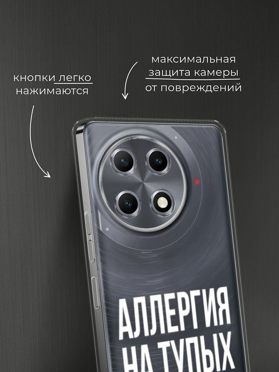 Чехол на Tecno Camon 30S / Текно Камон 30S с принтом "Аллергия на тупых", прозрачный — фото 1