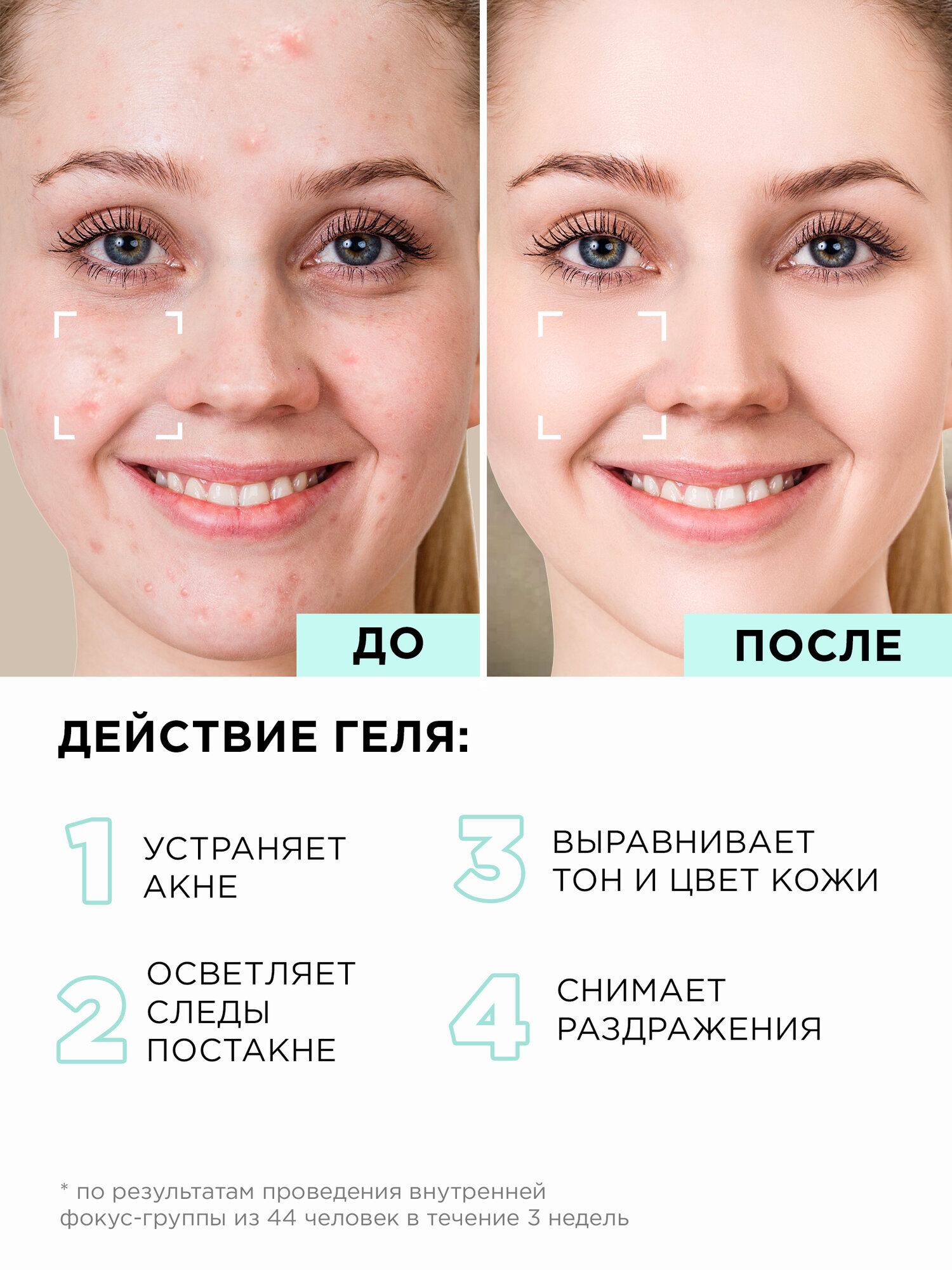 Косметические Наборы MIXIT Косметический набор для лица: себорегулирующая сыворотка от прыщей, акне и постакне и очищающий гель для умывания
