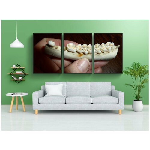 фото Набор модулных постеров для интерьера "протез, зубы, кариес" 60x90 см. в тубусе, без рамки lotsprints