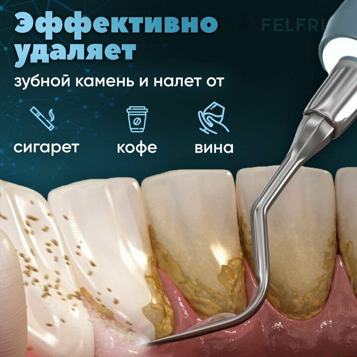 Скалер ультразвуковой для зубов FELFRI