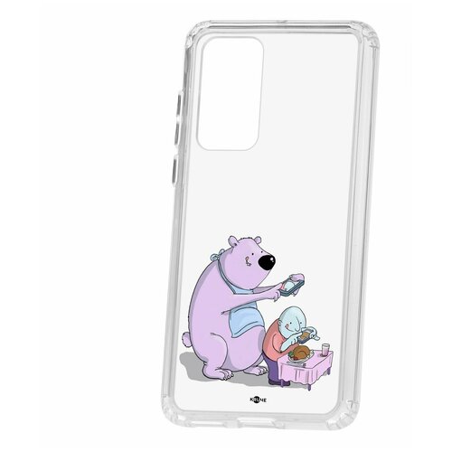 фото Чехол на huawei p40 kruche print foodstagramm / чехол для huawei / чехол с рисунком / чехол с принтом / чехол для хонор / чехол для хуавей / бампер на хуавей / чехол накладка для хонор / противоударная накладка для honor huawei / защита для honor / защита на huawei / cиликоновый чехол для huawei honor / пластиковый чехол на huawei / защитный чехол для honor / чехольчик / защита телефона / ударопрочный чехол кruче