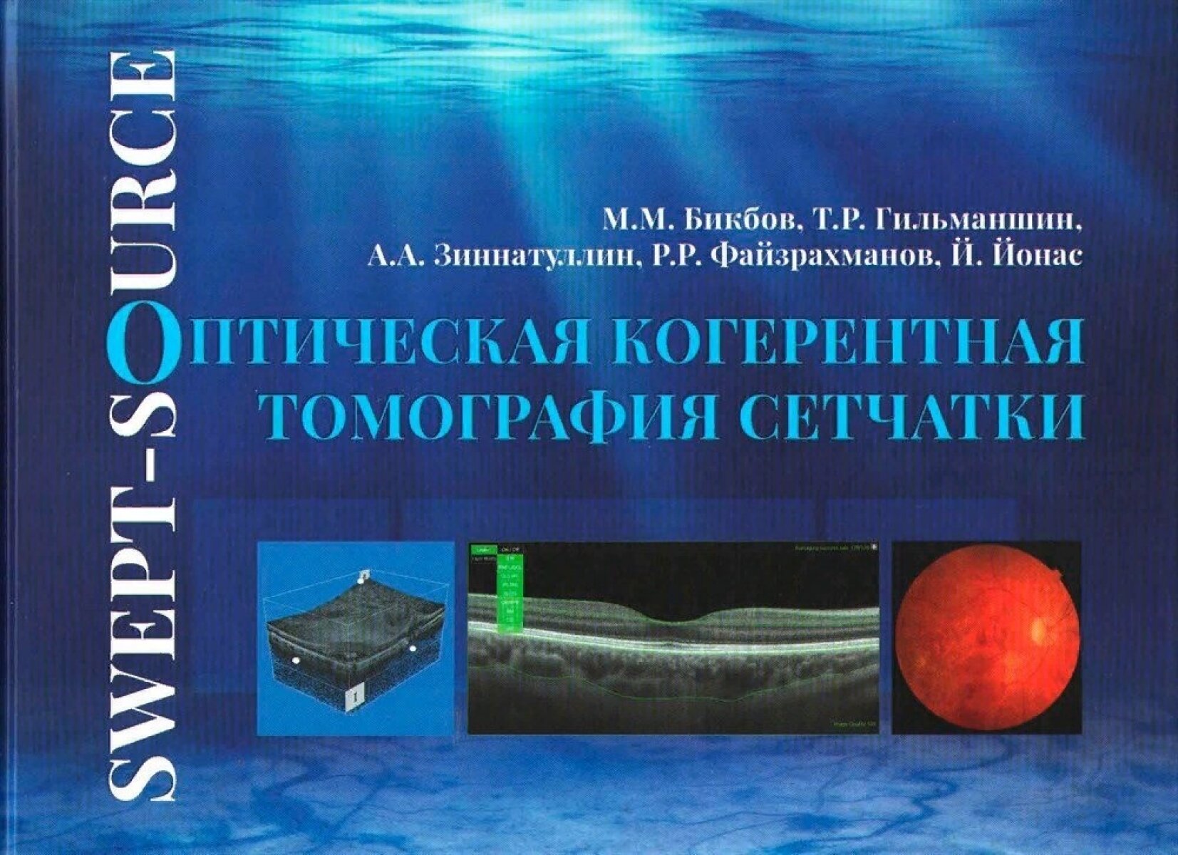 Оптическая когерентная томография сетчатки. Атлас- руководство