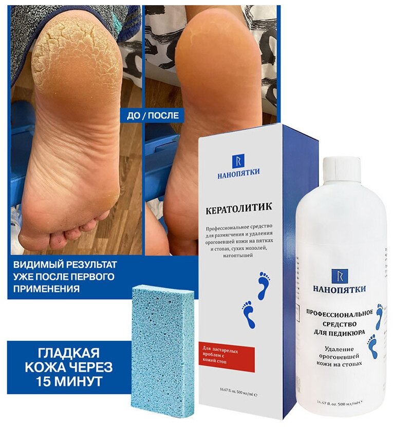 Нанопятки / Кератолитик - для застарелых проблем с кожей стоп - для удаления трещин, натоптышей + пемза