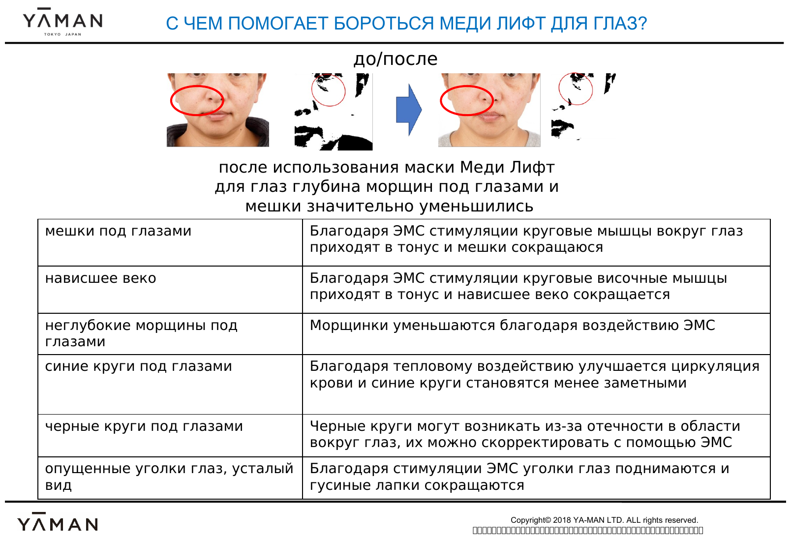 Лифтинг маска, блефаропластика для глаз, омоложение кожи вокруг глаз EMS , Medi Lift Eye YA-MAN - фотография № 17