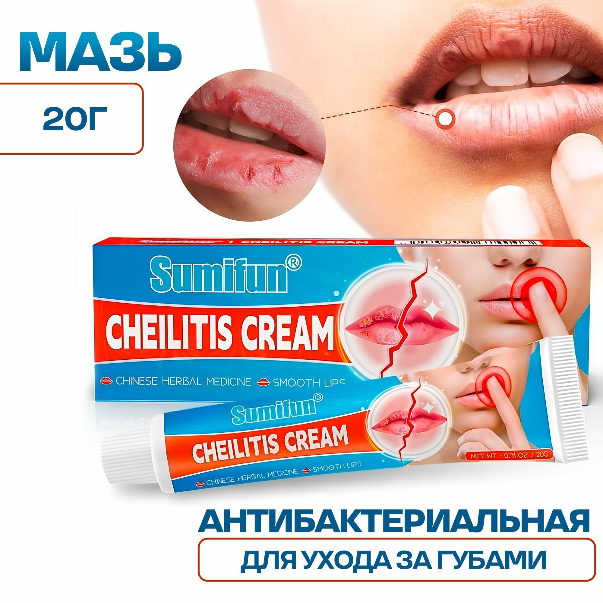 Антибактериальная мазь для ухода за губами, от холодов Cheilitis Cream