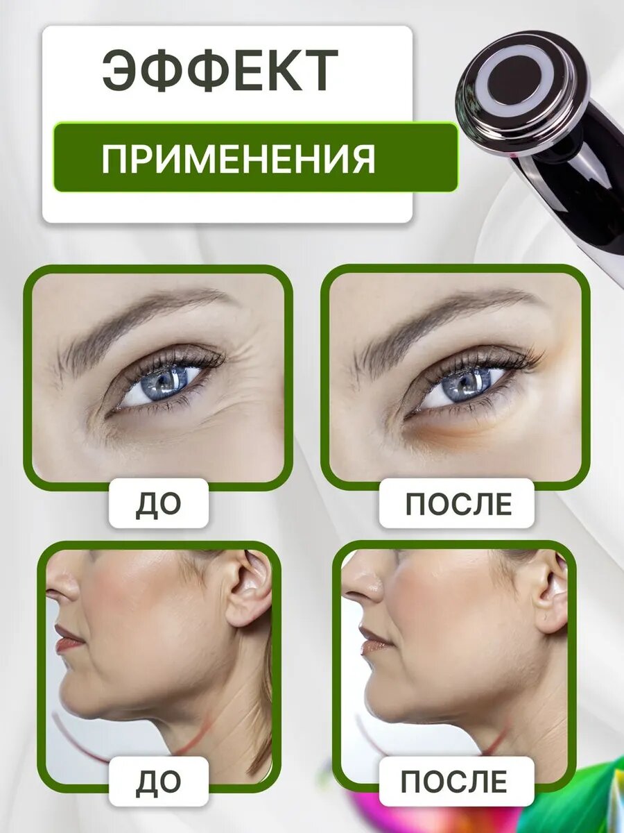 Изображение Микротоковый массажер для лица/ RF лифтинг/Массажер для лица электрический