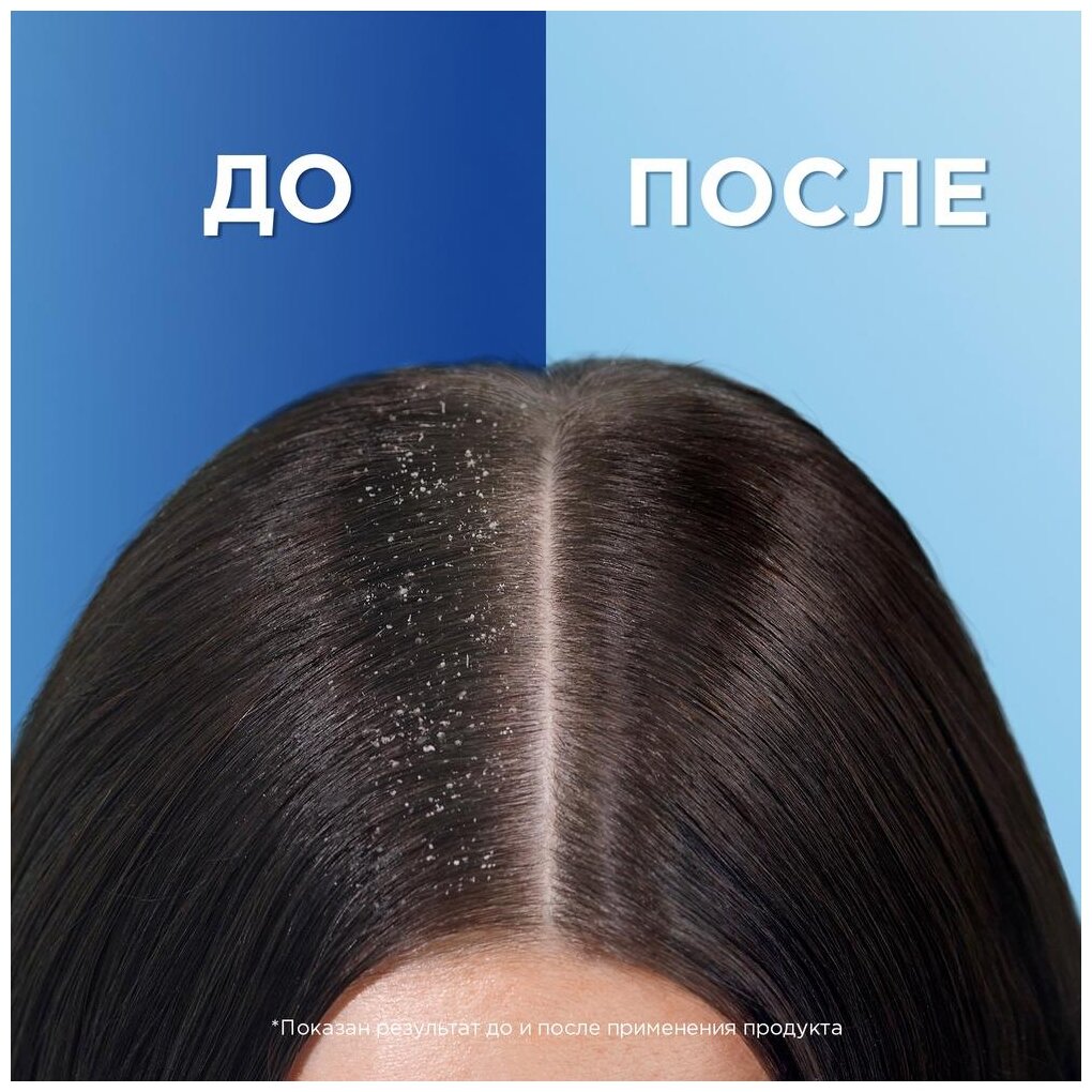 Head & Shoulders Шампунь против перхоти Ментол / Хед энд Шолдерс / 400мл - фотография № 4