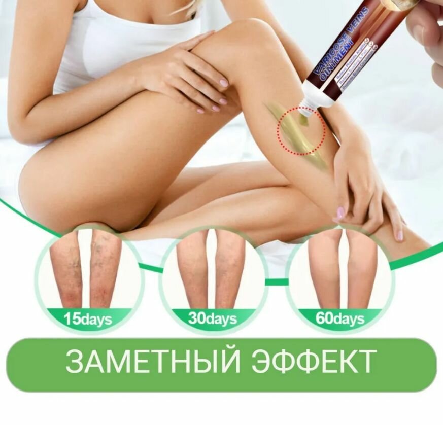 Изображение Крем от варикоза на травах 20 мл