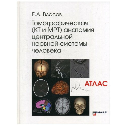Томографическая (КТ и МРТ) анатомия центральной нервной системы человека (Атлас)