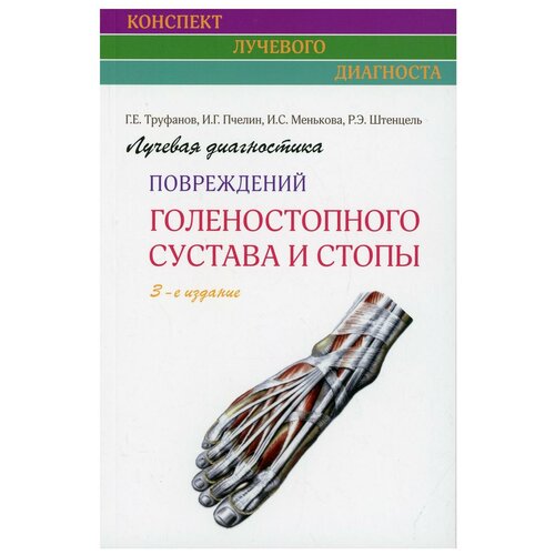 Лучевая диагностика повреждений голеностопного сустава и стопы