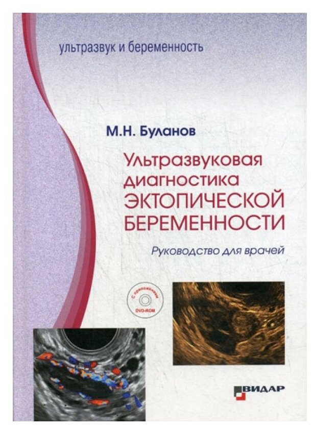 Ультразвуковая диагностика эктопической беременности: Руководство для врачей: с приложением DVD-ROM