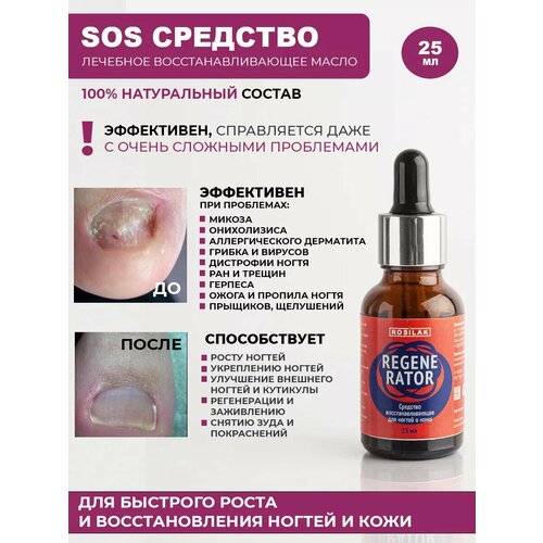 Rosilak, REGENERATOR - средство от аллергического дерматита и онихолизиса, 25 мл