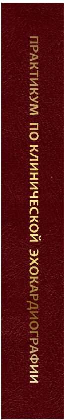 Практикум по клинической эхокардиографии. Руководство для врачей - фото №4