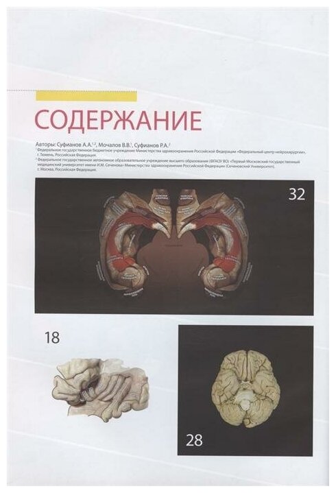 Атлас нормальной анатомии поверхности головного мозга при МР-томографии - фото №3