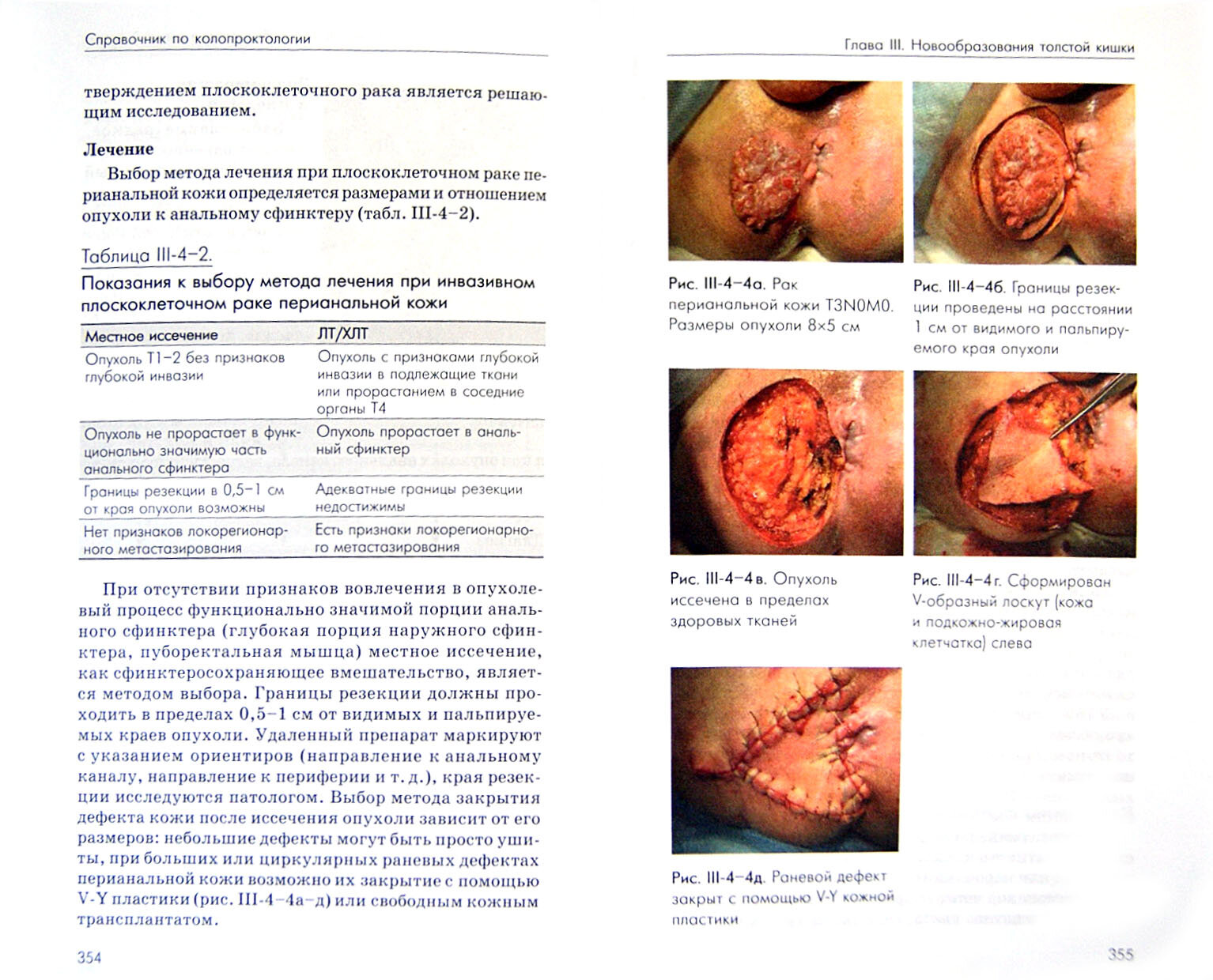 Справочник по колопроктологии (Шелыгин Юрий Анатольевич, Ачкасов Сергей Иванович, Благодарный Леонид Алексеевич) - фото №2