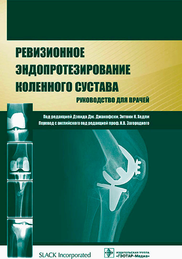 Ревизионное эндопротезирование тазобедренного сустава. Руководство для врачей - фото №3