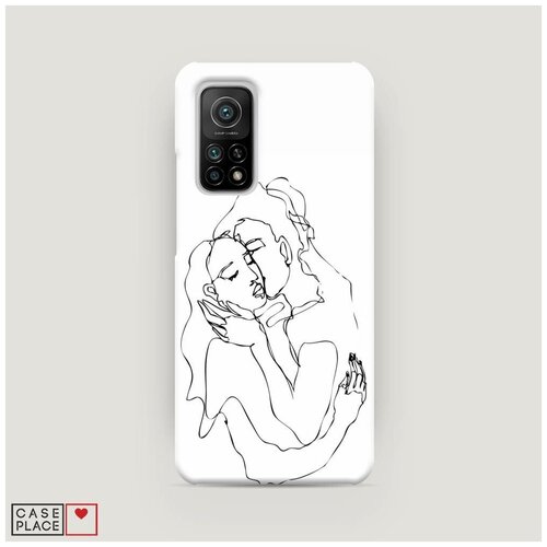 фото Чехол пластиковый xiaomi mi 10t pro поцелуй в щечку case place