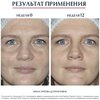 Фото #8 Eucerin Anti-Pigment Dual Serum Двойная сыворотка для лица против пигментации