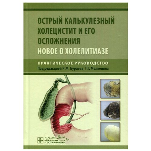 Острый калькулезный холецистит и его осложнения. Новое о холелитиазе. Практическое руководство | Буриев Илья Михайлович, Мелконян Георгий Геннадьевич