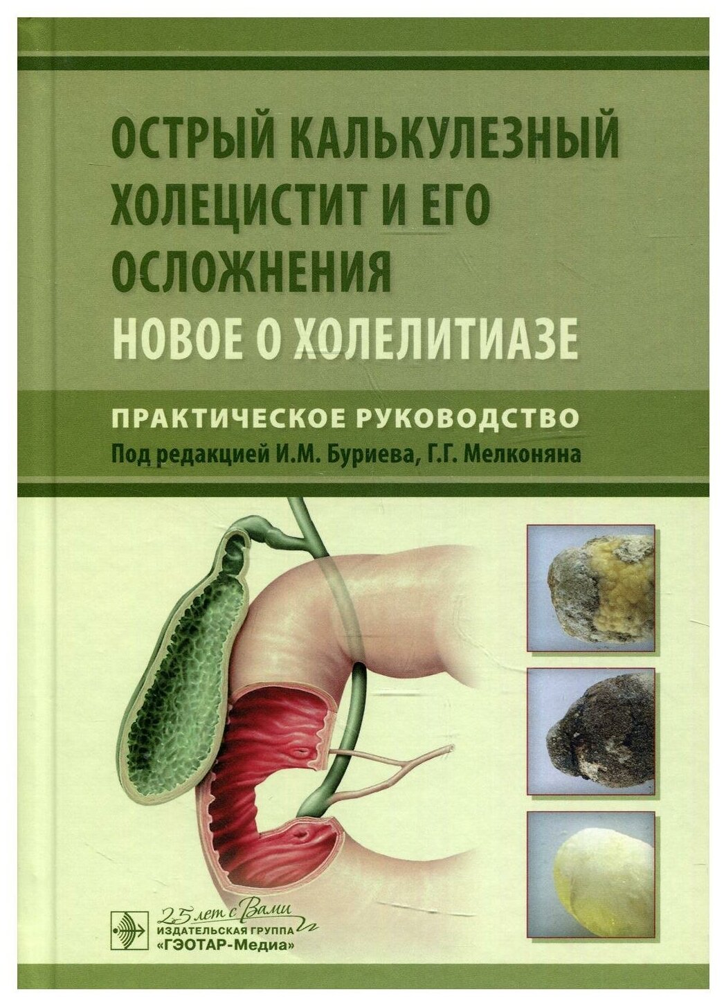Книга Острый калькулезный холецистит и его осложнения. Новое о холелитиазе - фото №1