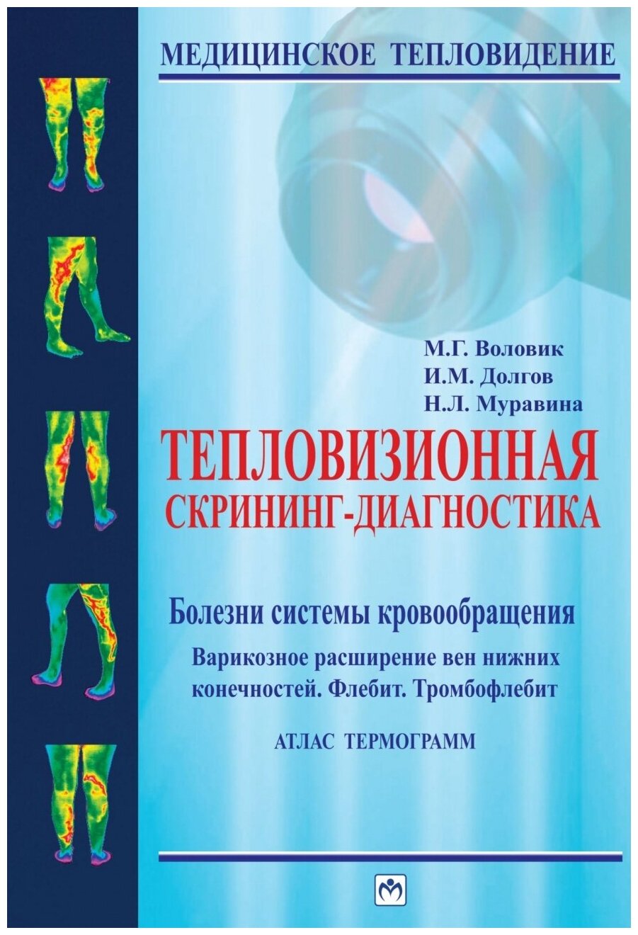 Тепловизионная скрининг-диагностика Болезни системы кровообращения Варикозное расширение вен нижних конечностей Флебит Тромбофлебит Атлас термограмм
