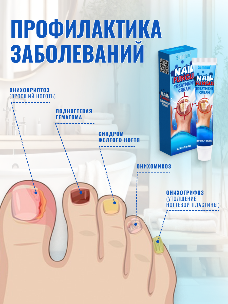 Средство от грибка ногтей на ногах Sumifun / Крем для борьбы с несовершенствами / Мазь для ухода за ногами против онихолизиса — фото 1