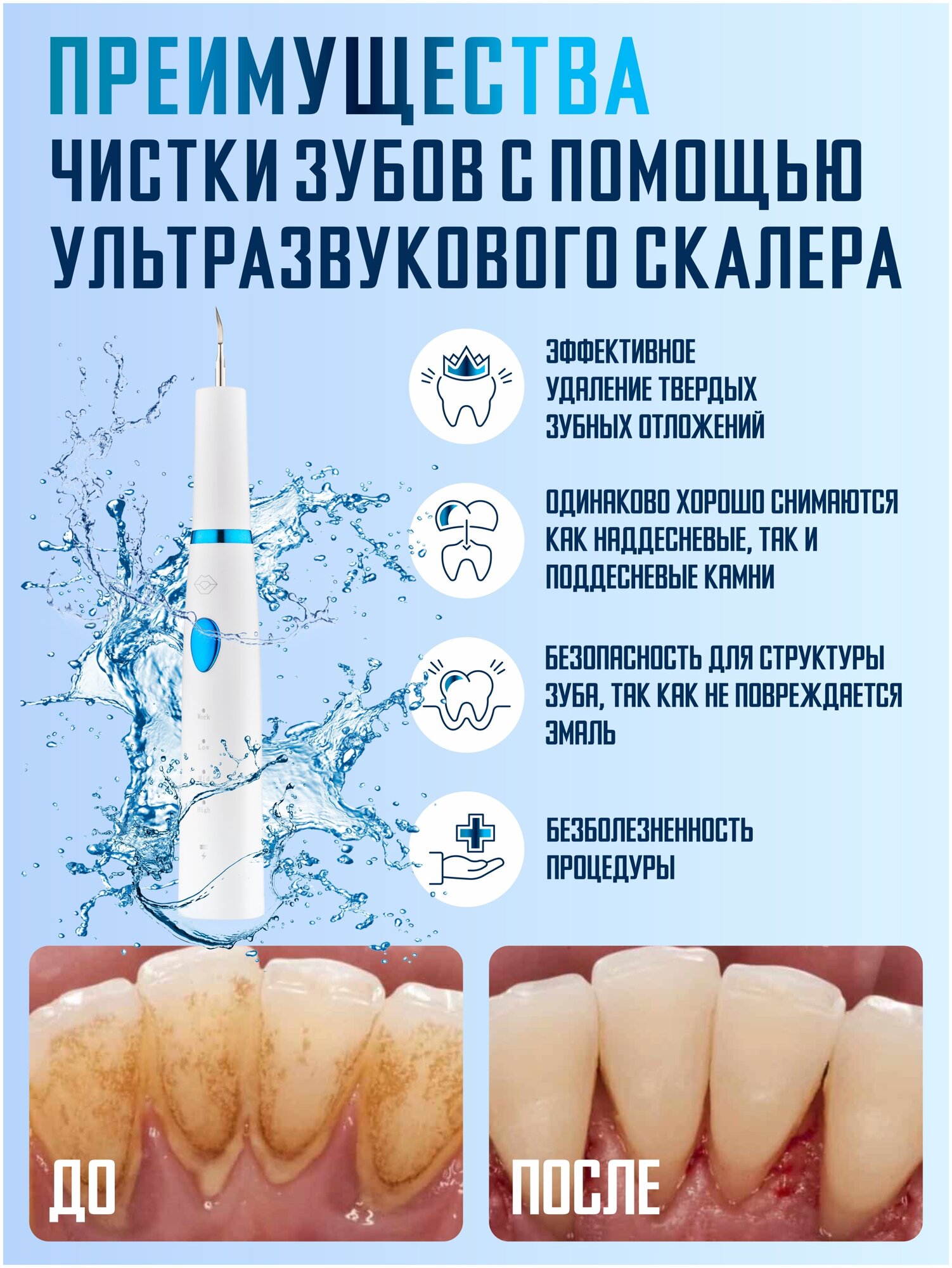 Ультразвуковой скалер для удаления зубного камня My Brilliant Smile 4 насадки - фотография № 9