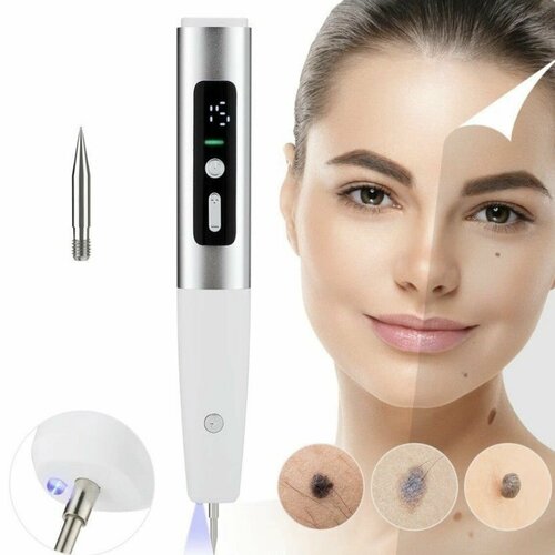 Аппарат косметологический для удаления веснушек родинок пигментных пятен татуировок бородавок папиллом шрамов 199900₽