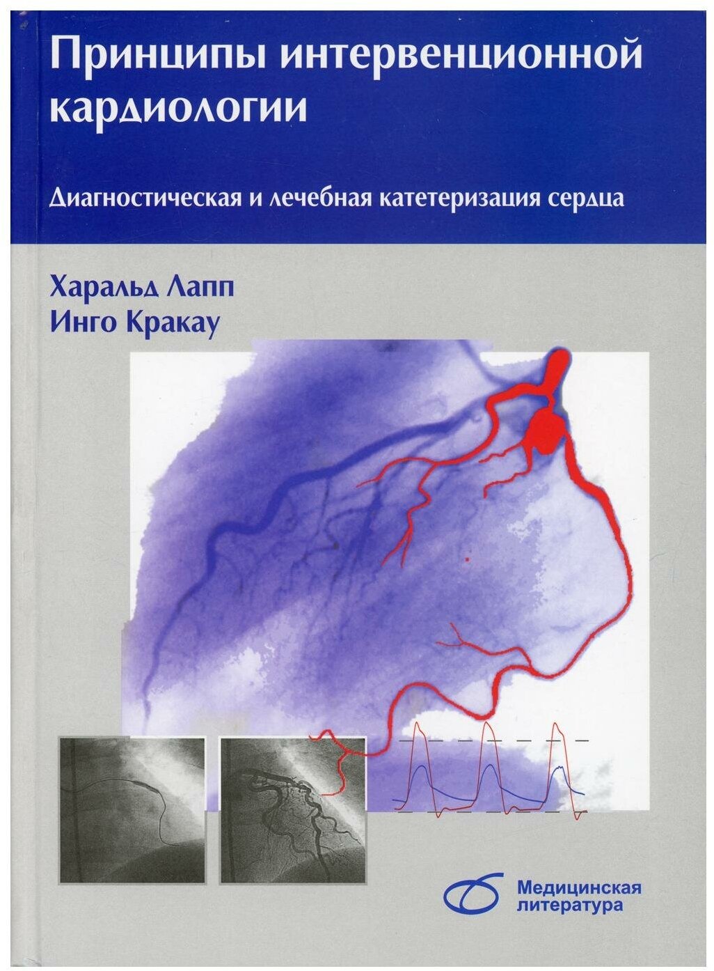 Принципы интервенционной кардиологии. Диагностическая и лечебная катетеризация сердца - фото №1