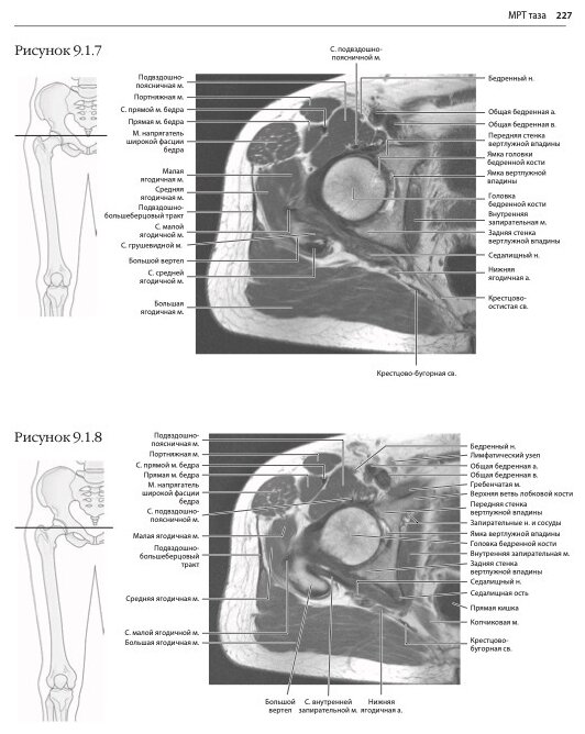 МРТ и КТ. Секционная анатомия (Марк В. Андерсон, Майкл Дж. Фокс) - фото №7