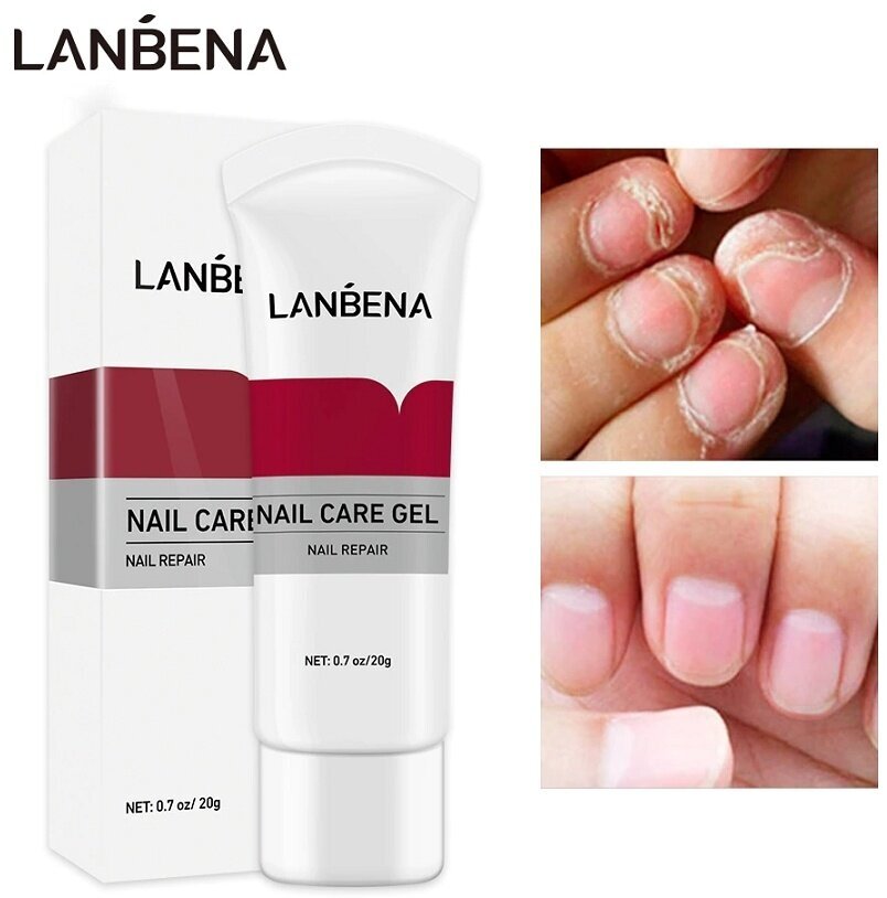 Средство от грибка ногтей на ногах LANBENA / Лечение укрепление ногтей / Противогрибковое экстракт масло для ног на ногти / Уход за ногтями