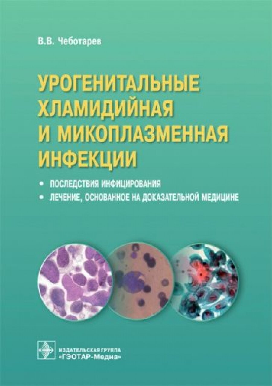 Урогенитальные хламидийная и микоплазменная инфекции. Последствия инфицирования, лечение, основанное на доказательной медицине