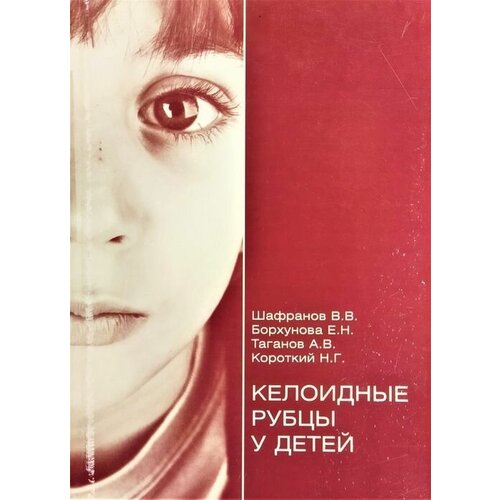 Келоидные рубцы у детей. Шафранов В.В.