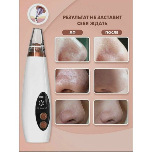 Вакуумный очиститель пор 69900₽