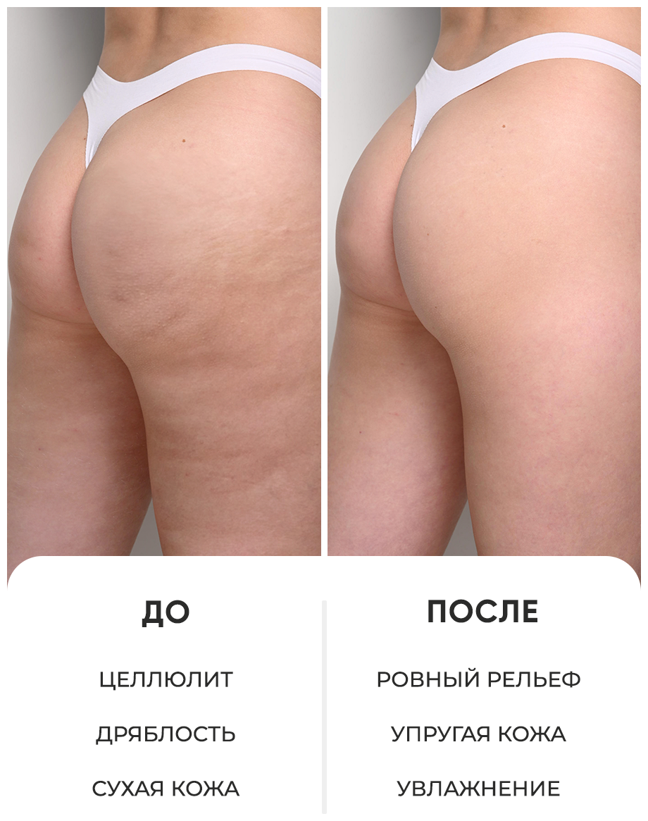 Likato Разогревающий крем-баттер против целлюлита Hot Butter, 200 мл (Likato, ) - фото №4