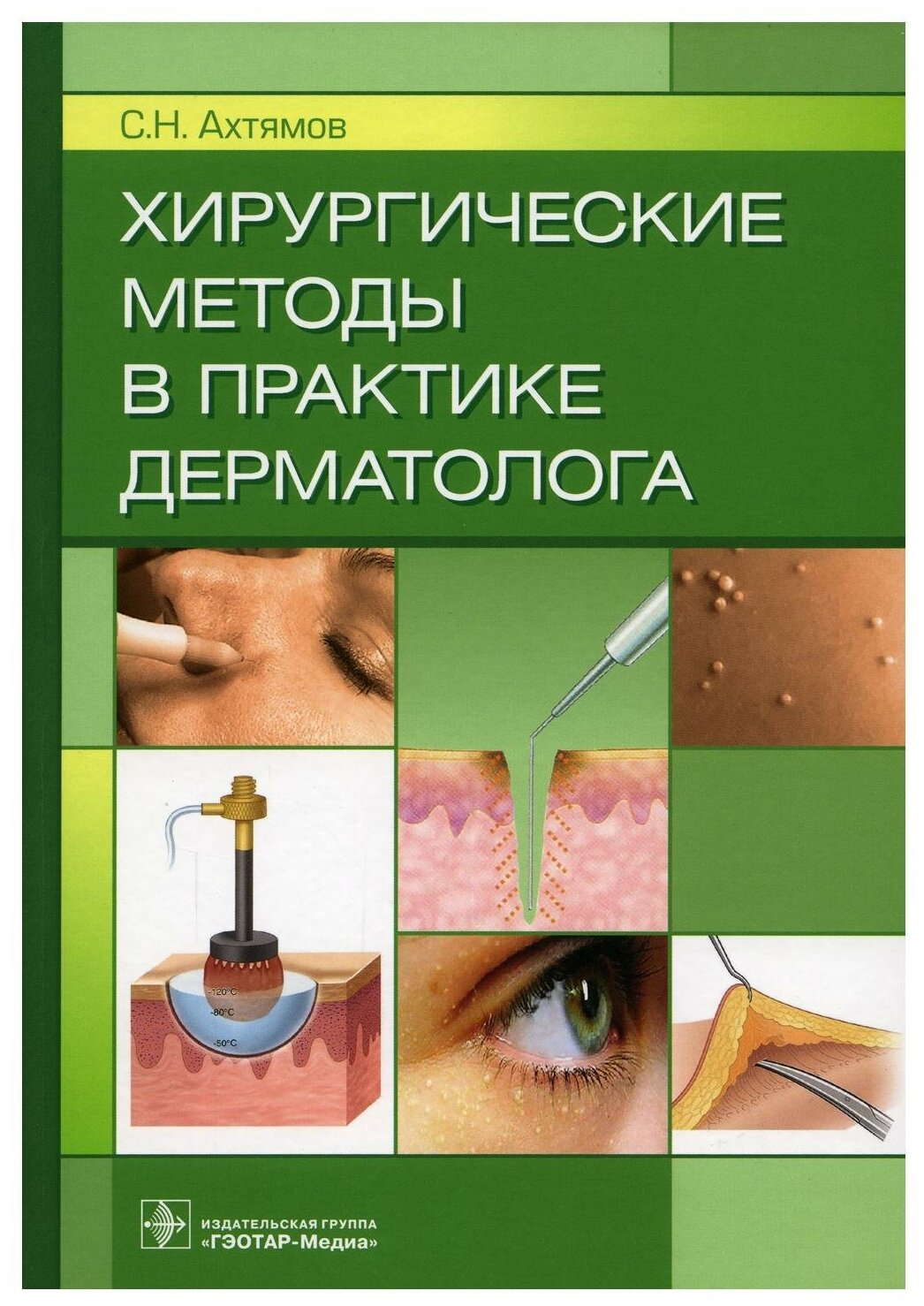 Хирургические методы в практике дерматолога - фото №1