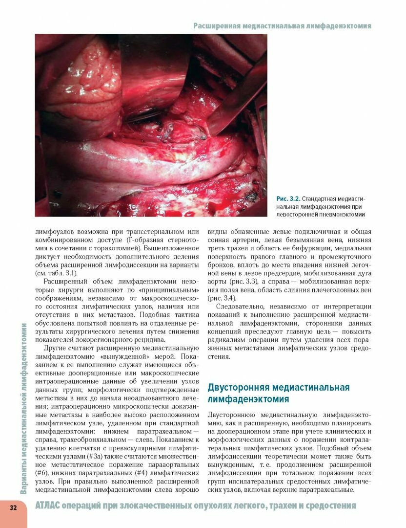 Атлас операций при злокачественных опухолях легкого, трахеи и средостения - фото №6
