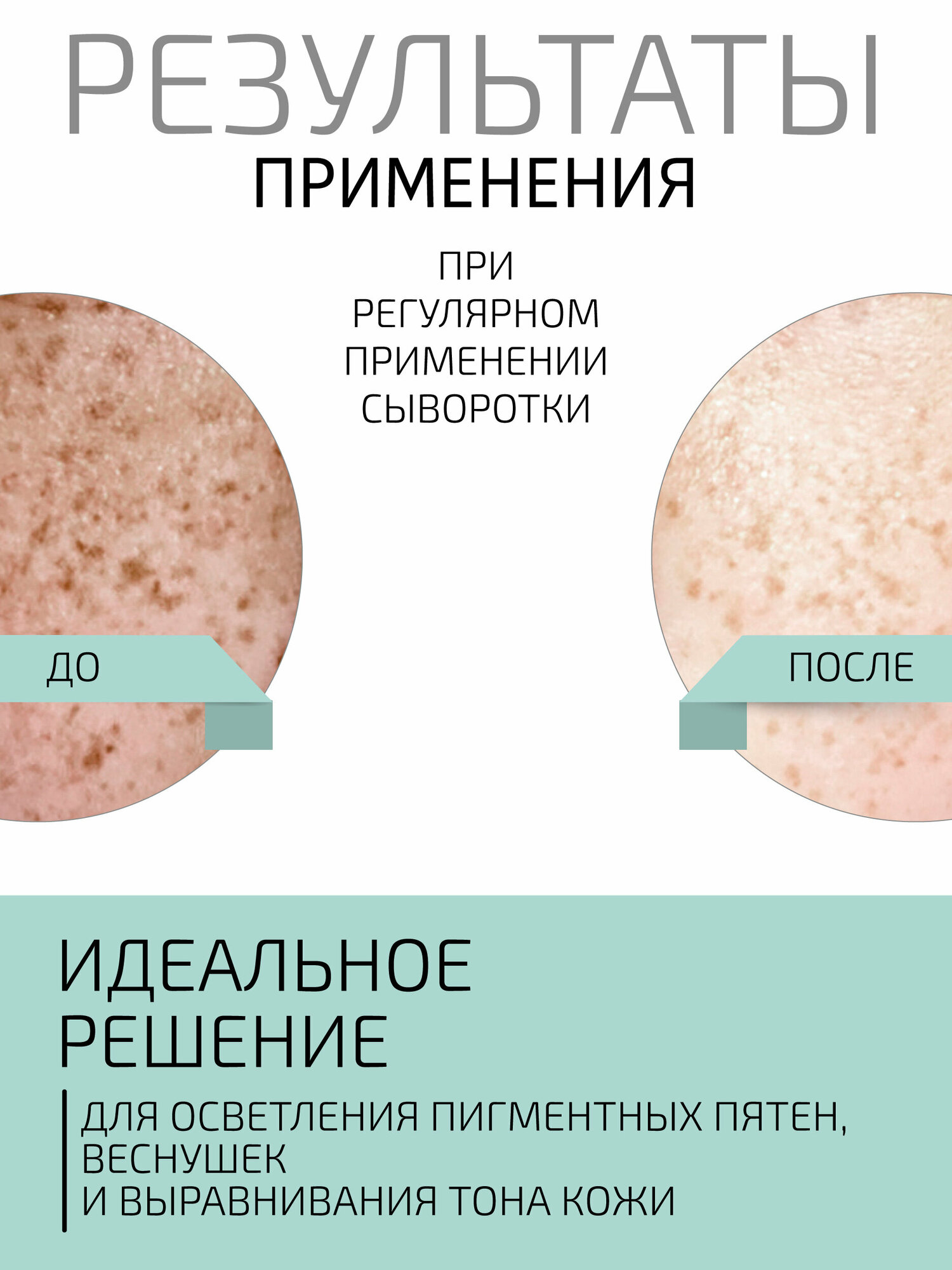 Изображение BTpeeL Липосомальная сыворотка с койевой и гиалуроновой кислотой, 30 мл