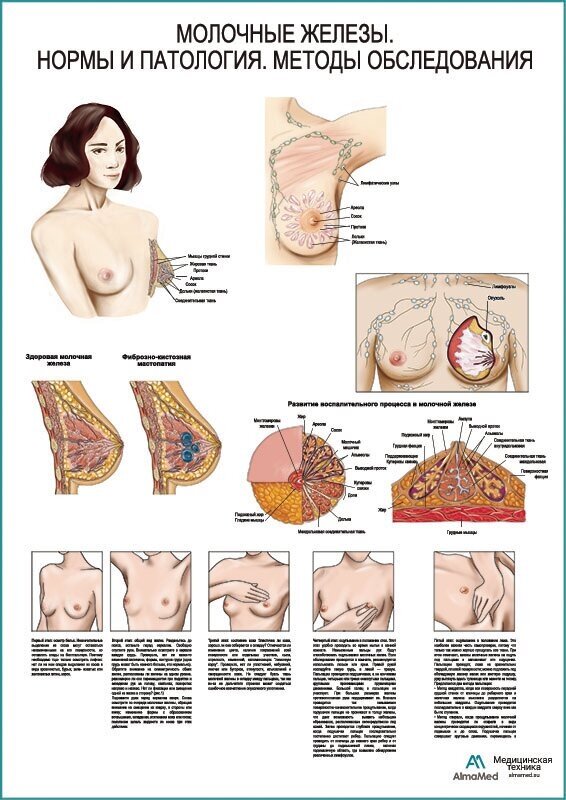 Молочные железы мастопатия самообследование (анатомия человека) плакат глянцевый А1+ плотная фотобумага от 200г/м2