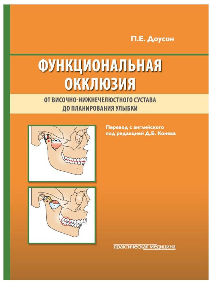 Функциональная окклюзия, Доусон П.