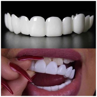 Стоит ли покупать Виниры для зубов Snapon Smile 2 шт (Белый)? Отзывы на ...
